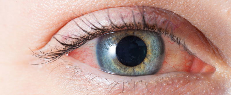 red-eye-of-woman.jpg