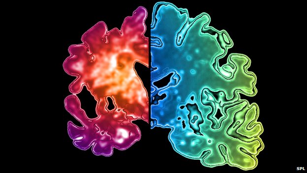 _71585693_brain.jpg