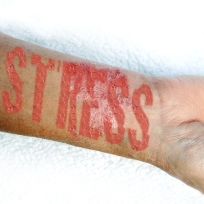 stress-psoriasis-400x400.jpg
