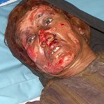 thumb_bala_baluk_wounded1.jpg