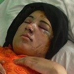 thumb_bala_baluk_wounded3.jpg