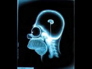 brainless.jpg
