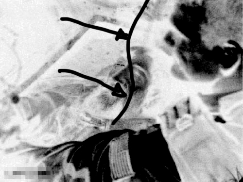 obl_dead-BW-Inverse2.jpg