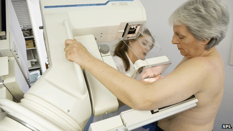 _59720340_c0027305-mammography_examin.gif