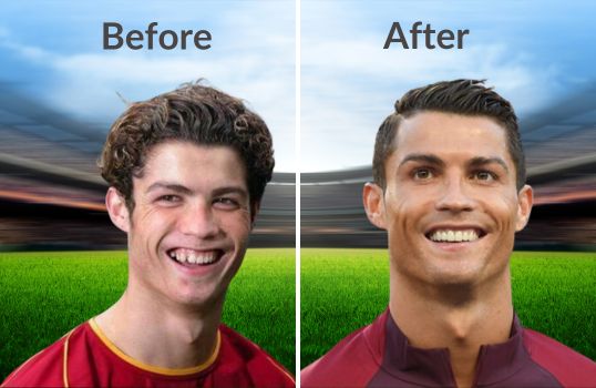 ronaldo-teeth-6.jpg