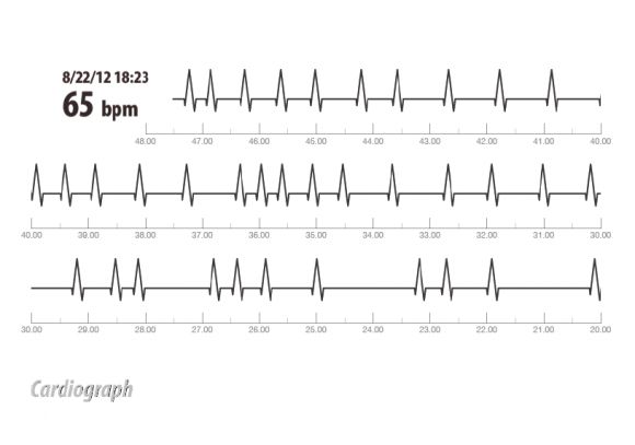 screen-capture-580x407.png
