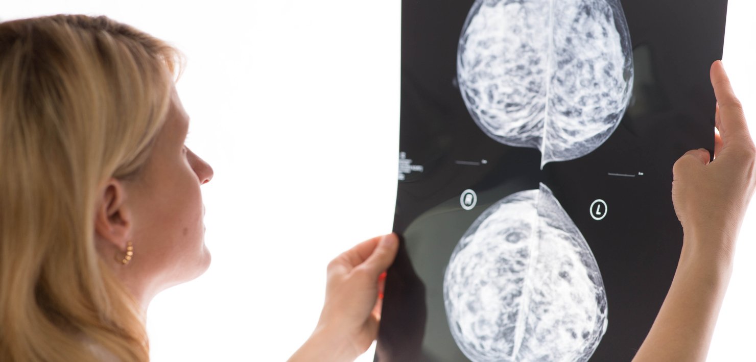 Breast-Cancer-Cryotherapy.jpg