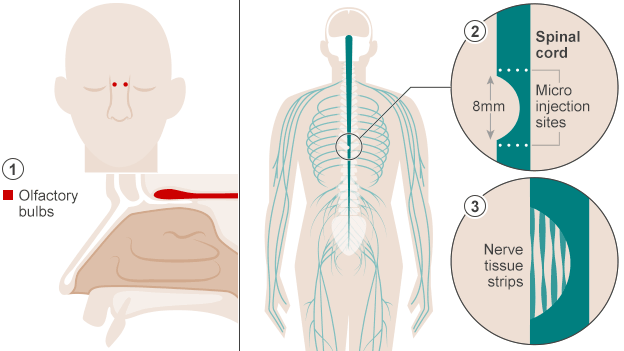 _78392534_spinal_cord_624.gif