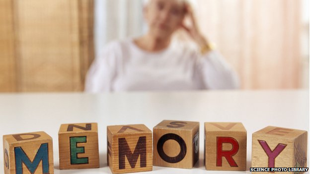_79675593_alzheimer_s_disease-spl.jpg