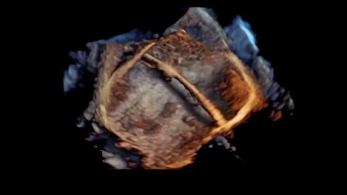 heart-4d-video-software.jpg