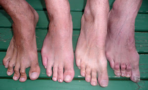 ugly+feet.jpg