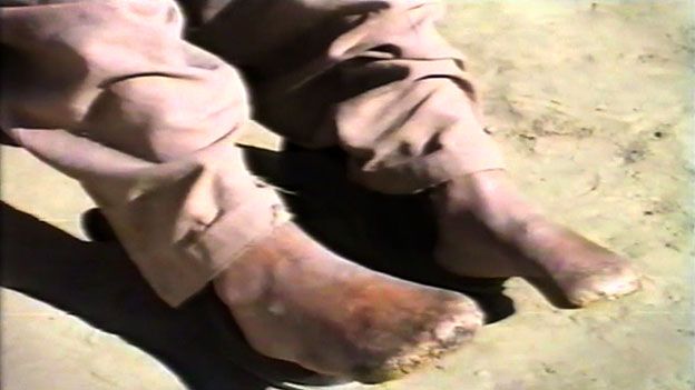 Amir Mehdi's mutilated feet