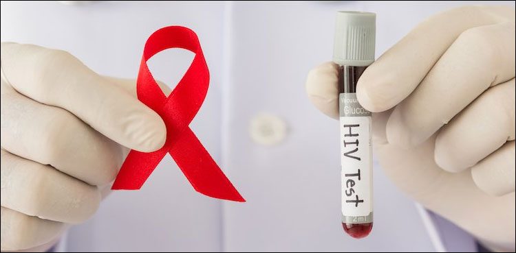HIV-AIDS-750x369.jpg